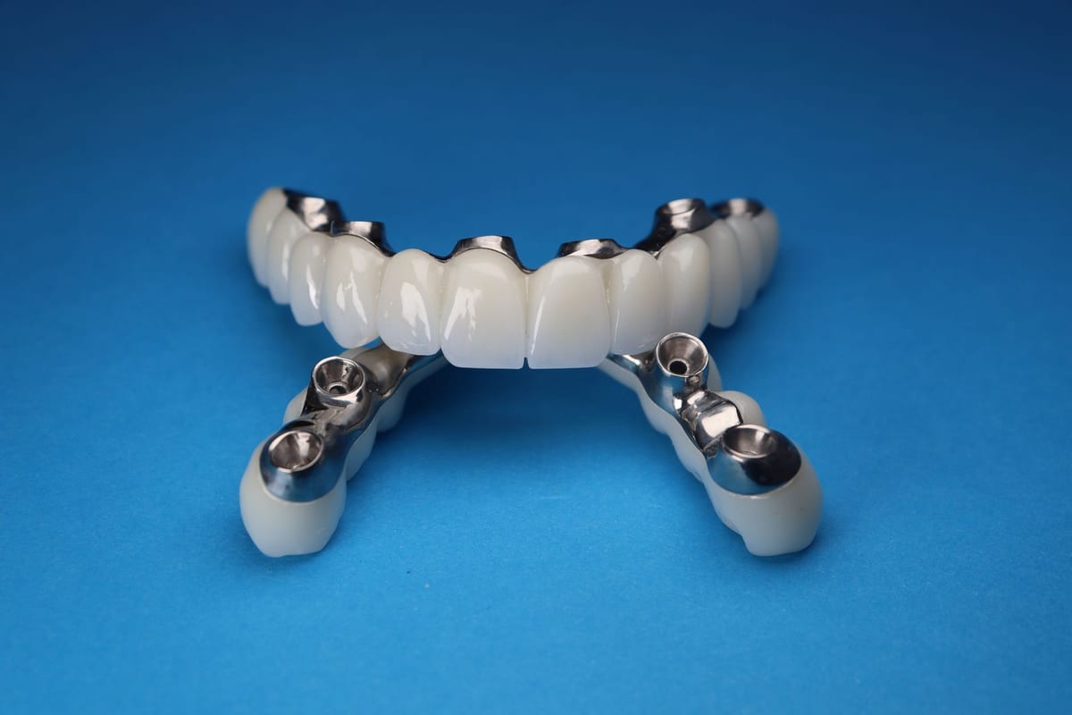 A three-unit implant-supported bridge with two fixtures beneath it