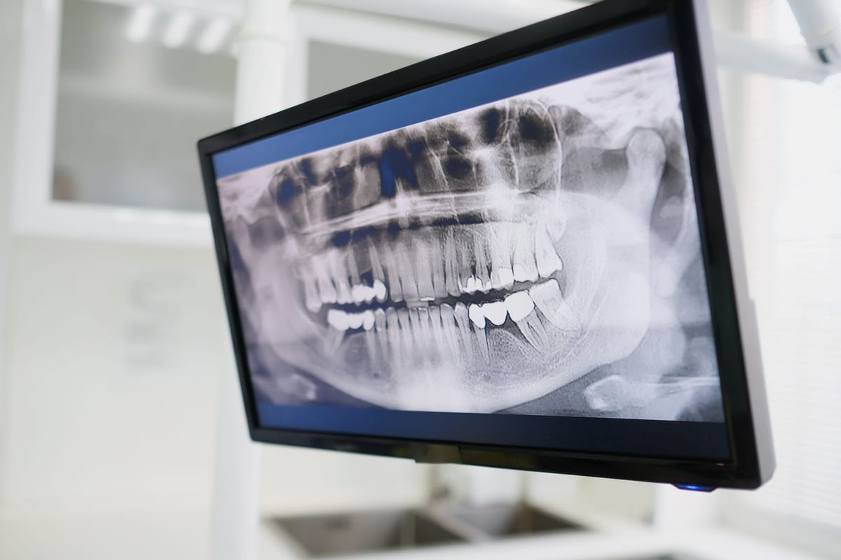 A chairside screen showing a panoramic dental radiograph beside the delivery unit